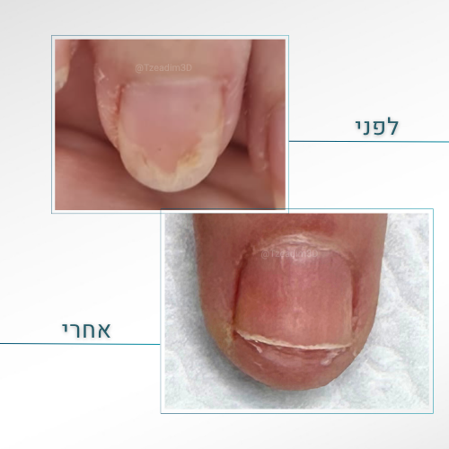 תמונה של טיפול